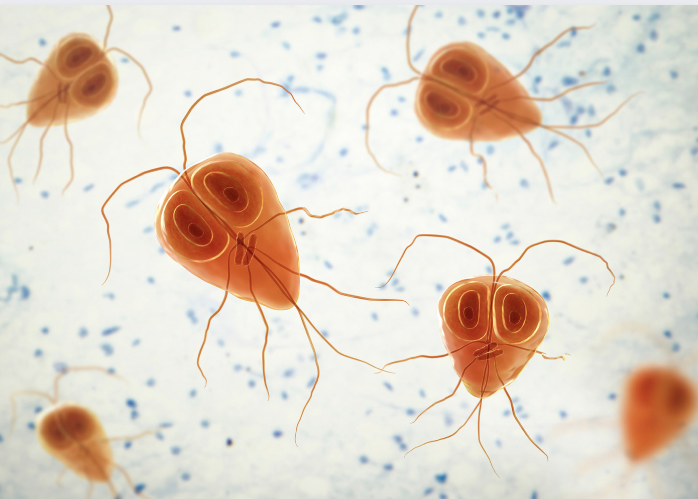 Giardiasis